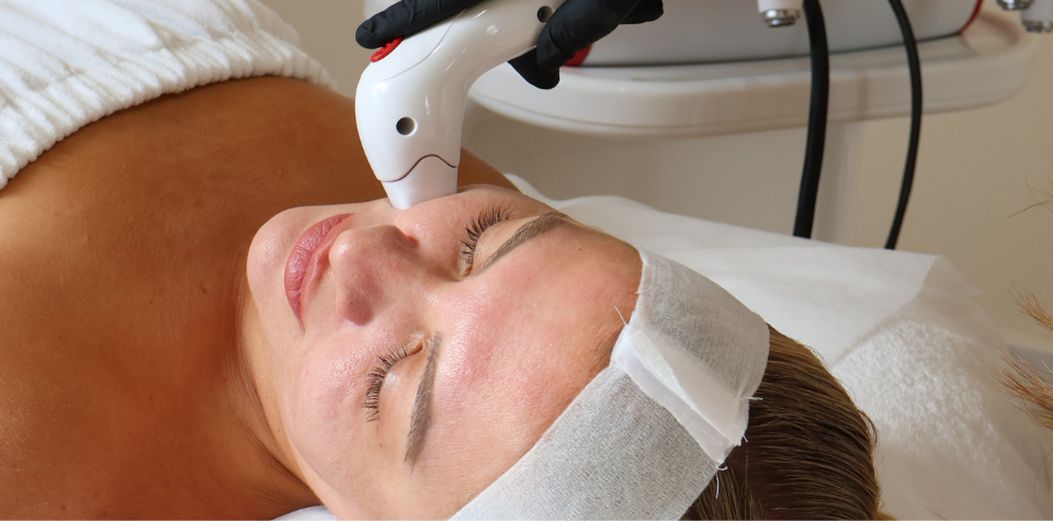 Fine Lines & Wrinkles