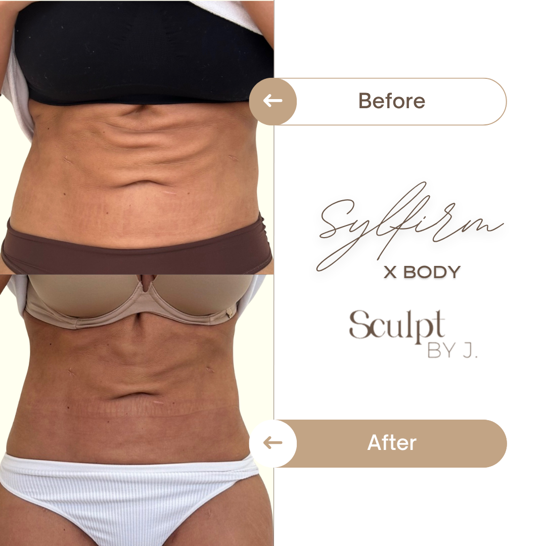 Thuzzle-Resurfacing_2