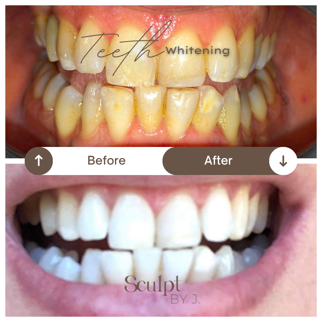 Thuzzle-Resurfacing_2