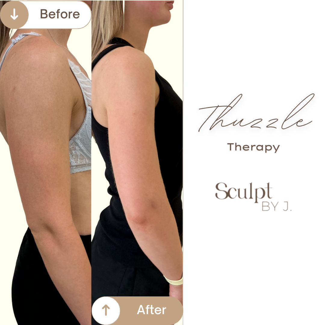 Thuzzle-Resurfacing_2