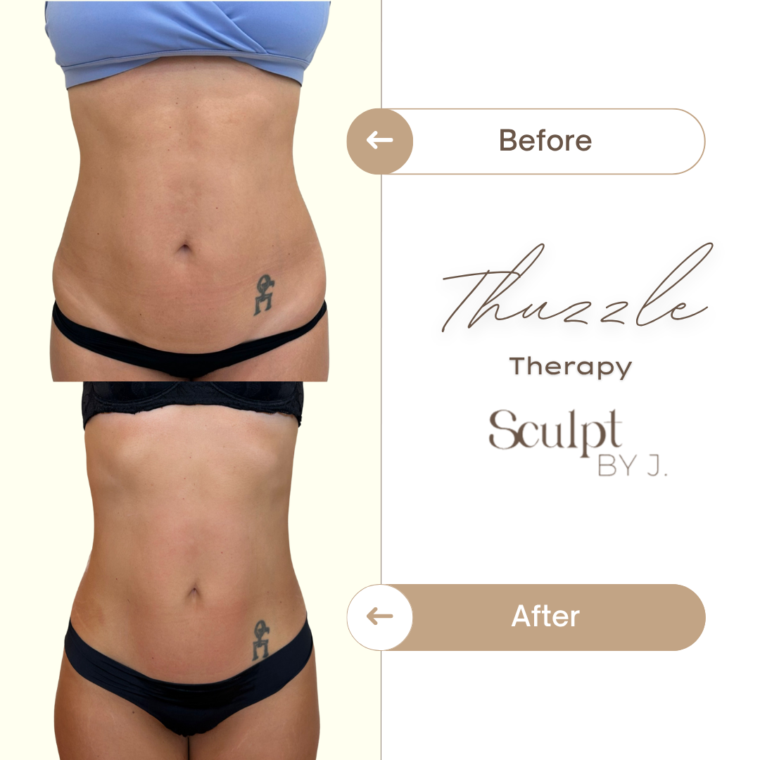 Thuzzle-Resurfacing_2