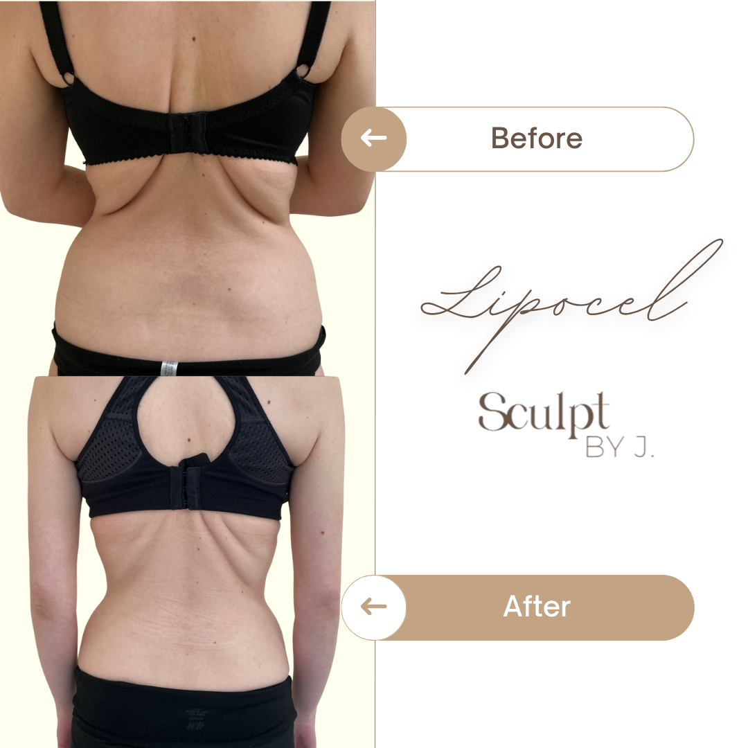 Thuzzle-Resurfacing_2