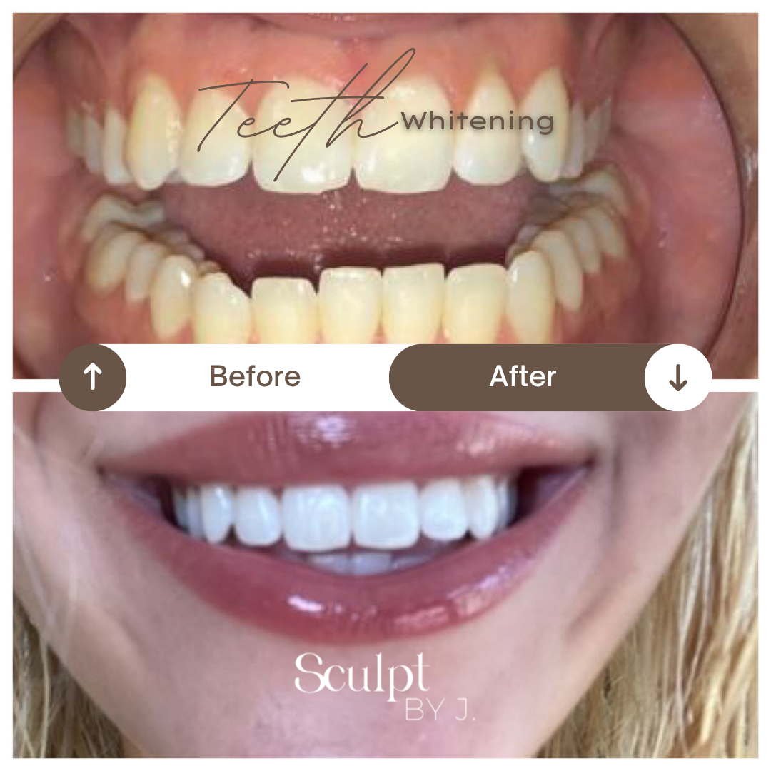 Thuzzle-Resurfacing_2